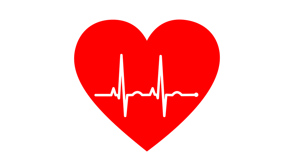 Heart EKG Medicare Nuclear Stress Test.png